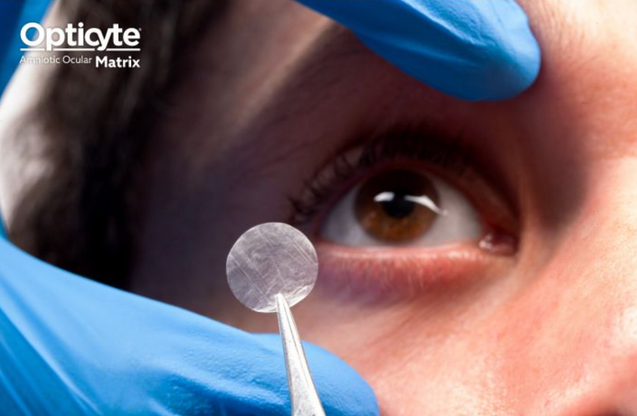 Opticyte® Surgical Repair Graft 1x1