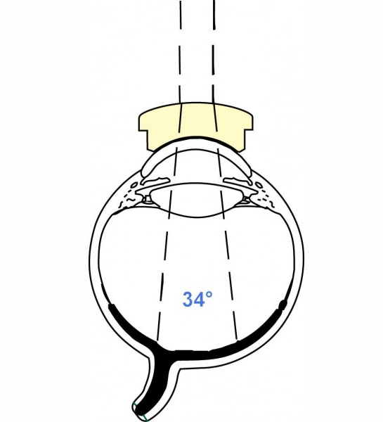 Magnifying Lens Optego Singapore