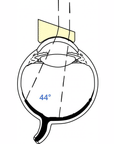 Landers High Reflective Index Lens - 20° Prism Lens