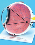 Eye Model - LASIK