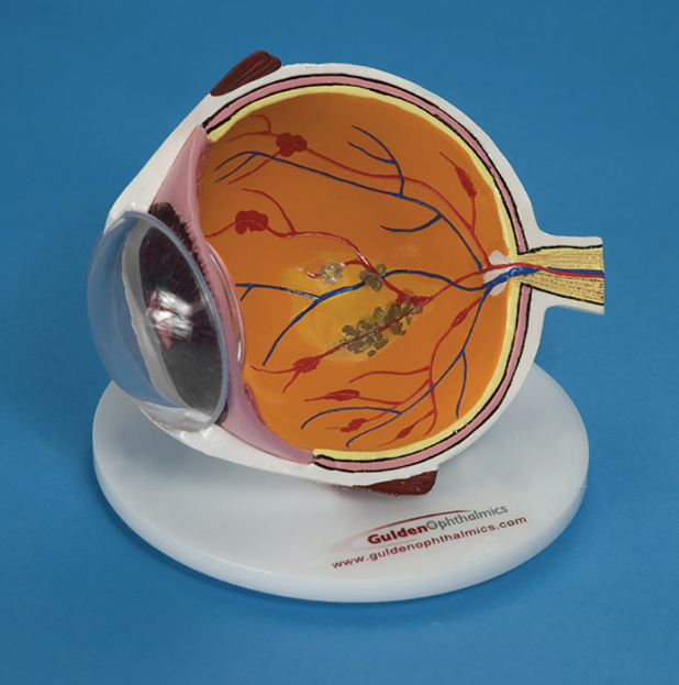 Eye Model - VTD – Optego Singapore